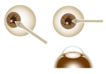 50nokaze (50nokaze)さんのカタログ・説明資料用の眼球及び眼科メスのテクニカルイラストへの提案