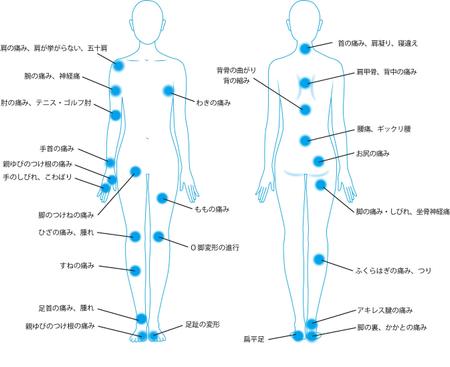 整形外科で利用する体の症状を説明するイラストの依頼 外注 イラスト制作の仕事 副業 クラウドソーシング ランサーズ Id