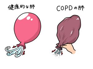 Ruk (taira_ruku)さんのクリニックの疾患解説ページ（慢性閉塞性肺疾患）のイラストへの提案