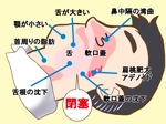 なゆたん (YukoIshii)さんのクリニックの疾患解説ページ（睡眠時無呼吸症候群）のイラストへの提案