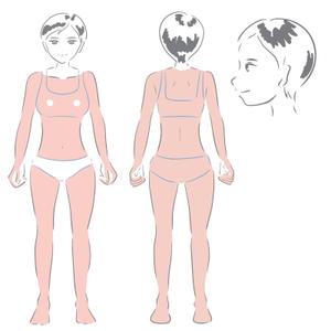 まのあやか (bipomaru)さんの「医療脱毛クリニック」の女性のイラストへの提案