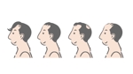 sumiyochi (sumiyochi)さんの男性の薄毛イメージイラストへの提案