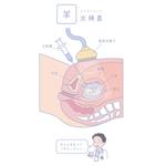 r_s2017 (r_s2017)さんの産科診療のイラスト　羊水検査・絨毛検査への提案