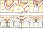 aureolin86 (aureolin86)さんの歯科手術のイラスト作成への提案