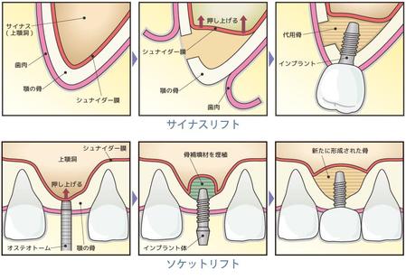 aureolin86 (aureolin86)さんの歯科手術のイラスト作成への提案