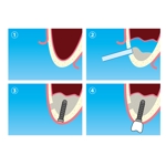 blue_aqua_blue (blue_aqua_blue)さんの歯科手術のイラスト作成への提案