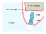 おじょー@医学生デザイナー (ojou00)さんの歯科手術のイラスト作成への提案