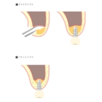 ＣＨＩＭＡ (chima_)さんの歯科手術のイラスト作成への提案