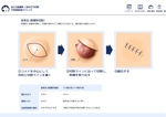 tamatsune (tamatsune)さんの粉瘤の手術のイラスト(従来法)への提案