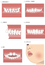 ぽまめ工房 (pomane_kobo)さんの歯科治療の説明用の小チラシ（各治療ごとや初診時に渡す啓蒙用）への提案