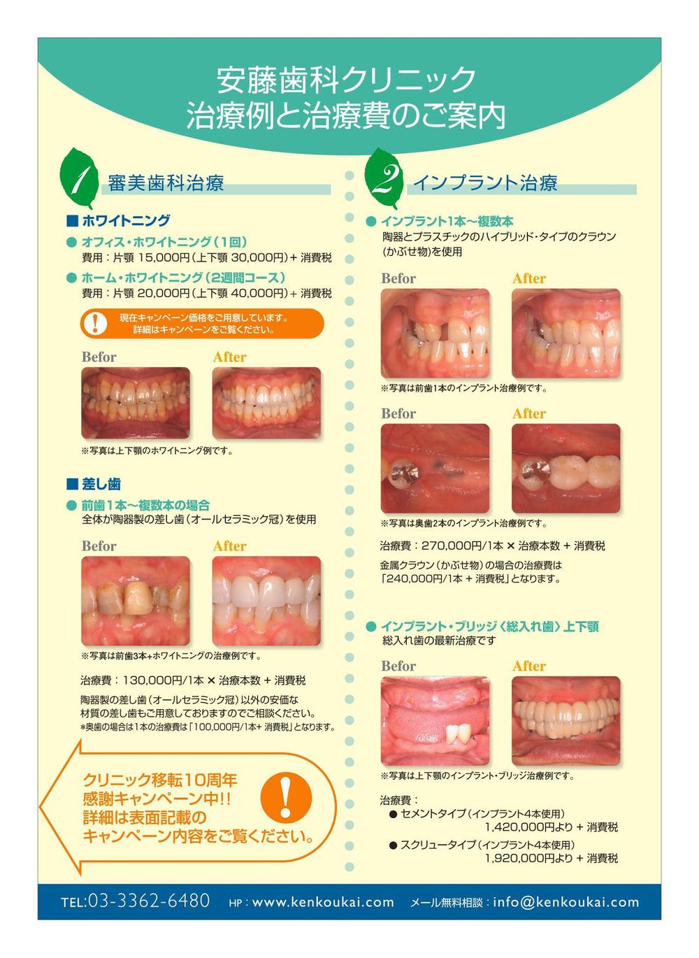 歯科医院の治療費案内のチラシデザイン　A4サイズ片面