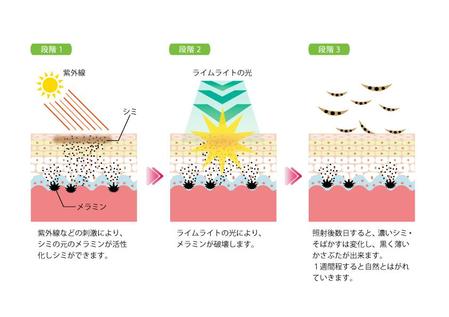 Figfig1969さんの事例 実績 提案 肌断面図のイラスト２つ Alpho 様お世話 クラウドソーシング ランサーズ