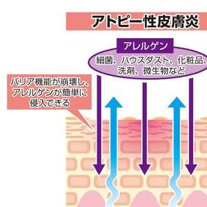 アトピー性皮膚炎のメカニズムイラスト作成 継続依頼有 に対するtomisandegozaiの事例 実績 提案一覧 Id イラスト制作の仕事 クラウドソーシング ランサーズ