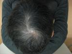 kachou_fuugetuさんの頭皮のモニター写真を募集します。への提案