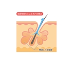 fujiyouさんの美容外科サイトのイラスト作成への提案