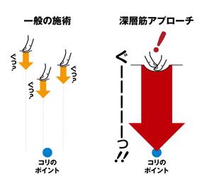 beat3886さんのあるマッサージ技術を平面で伝える表現を考えて欲しいへの提案
