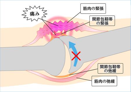 関節のイラスト 同じようなイラストを少し変えて５枚 添付のイラストを参考に作成お願いします の依頼 外注 イラスト制作の仕事 副業 クラウドソーシング ランサーズ Id