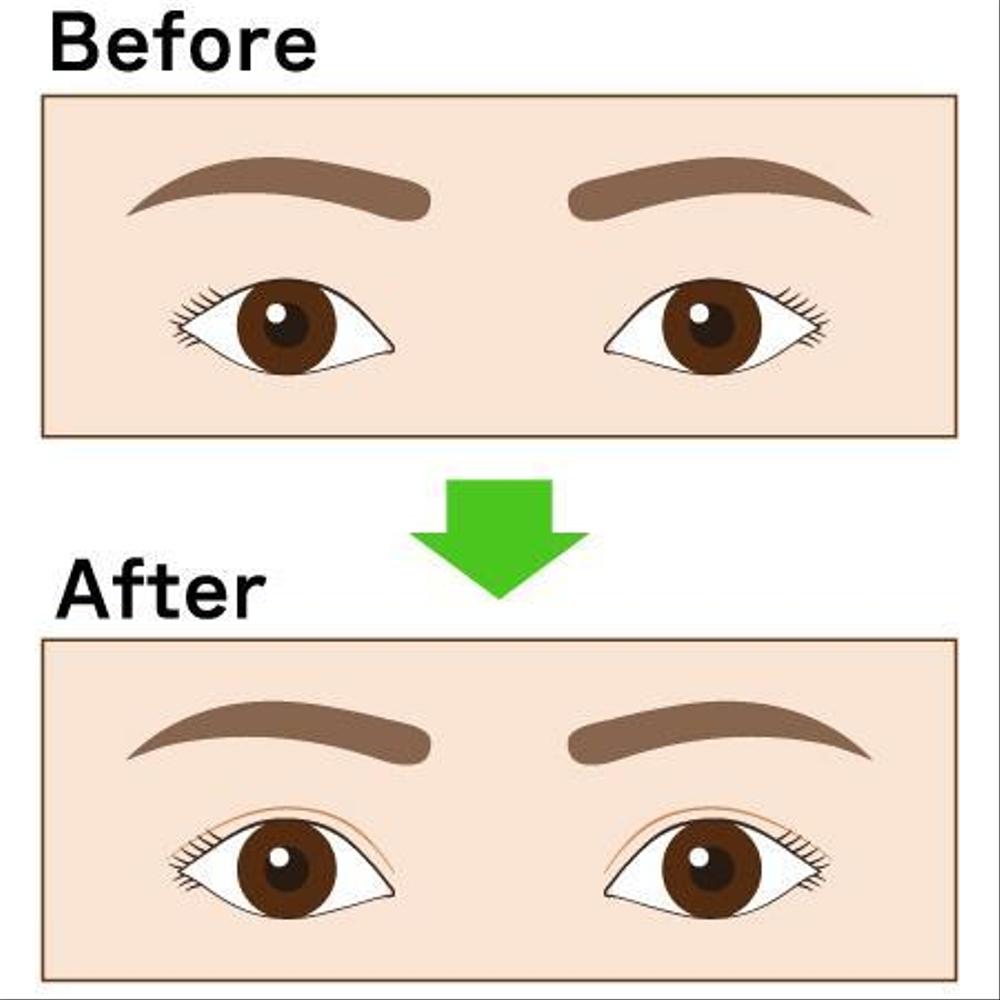 Ebtenさんの事例 実績 提案 二重まぶたのビフォーアフターイラスト 初めまして 二重まぶ クラウドソーシング ランサーズ