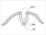 ima_gogo (ima_gogo)さんの医療用教材　線画　イラスト制作　7図　SP8-4⑦への提案