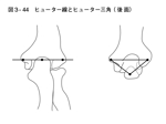 イラストレーター 恩地　晴美 (haru_natu)さんの医療用教材　線画　イラスト制作　7図　SP8-4⑦への提案