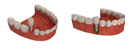 もにっこ (monichyan)さんの歯科医院ホームページに使用する歯に関するイラストへの提案