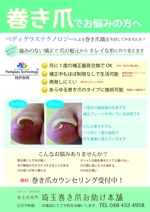 torazi104さんの巻き爪矯正のチラシのデザイン（現在使用中のチラシあり）への提案