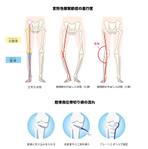 CUBE (cube1)さんの病院ホームページに掲載する手術図式イラストへの提案