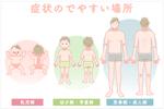 なないろ工房 (nanapoke)さんの【当選確約 / 報酬 12,500円】医療イラスト 2枚 / 皮膚科医院サイトの疾患イラストの作成への提案