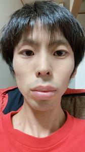 Ryo