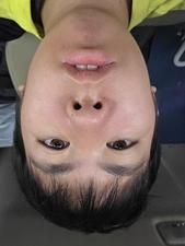 45309644