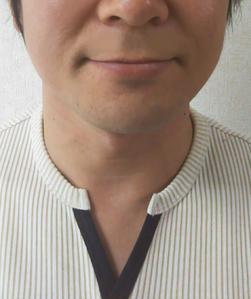 はる